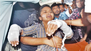 যন্ত্রণায় ছটফট দগ্ধরা,বার্ন ইউনিটে হৃদয়বিদারক দৃশ্য