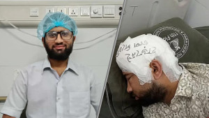 ফ্রিজে রাখা খুলি মামুনের মাথায় প্রতিস্থাপন