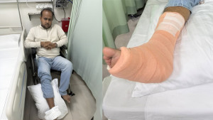 সিঁড়ি দিয়ে নামতে গিয়ে পা ভাঙলেন ছাত্রদল নেতা হামীম