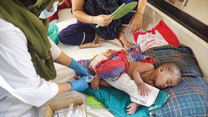 হাম ও উপসর্গে আরও ৩ শিশুর মৃত্যু