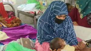 হাম ও উপসর্গ নিয়ে আরও ৩ শিশুর মৃত্যু