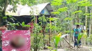 চুরি করতে এসে ধরা, গৃহবধূর কামড়ে চোরের আঙুল বিচ্ছিন্ন