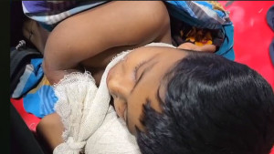 ককটেল বিস্ফোরণে গুরুতর আহত শিশুকে ঢাকায় প্রেরণ