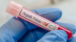 দেশে নিপা ভাইরাসে বছরের প্রথম মৃত্যু