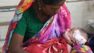 হামের উপসর্গ নিয়ে আরও ৫ শিশুর মৃত্যু