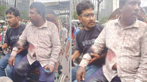 ব্যবসায়ীকে গুলি করে টাকার ব্যাগ নিয়ে গেল দুর্বৃত্তরা