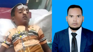 এনপিপি নেতার করা খতনায় শিশুর অবস্থা আশঙ্কাজনক