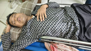 থানায় অভিযোগ করায় যুবকের পায়ের রগ কাটলেন বহিষ্কৃত যুবদল নেতা