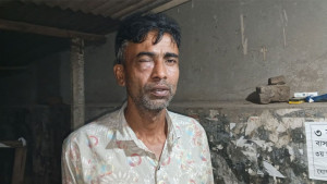 বিল বেশি না করায় হোটেল কর্মচারীকে পিটিয়ে জখম